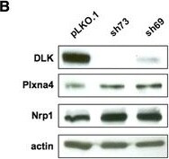 Actin Gamma 1 Antibody