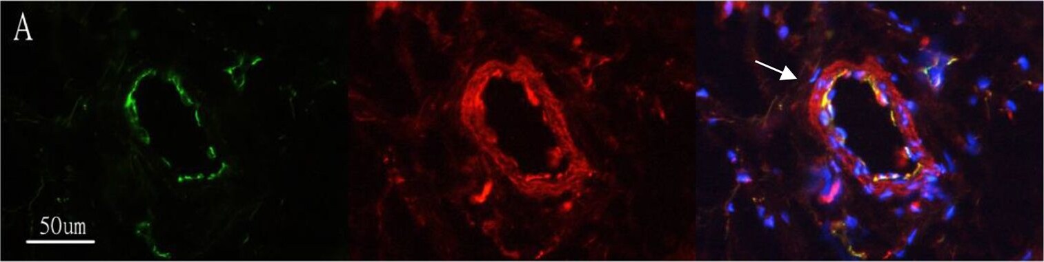 CD31/PECAM-1 Antibody (JC/70A) - BSA Free
