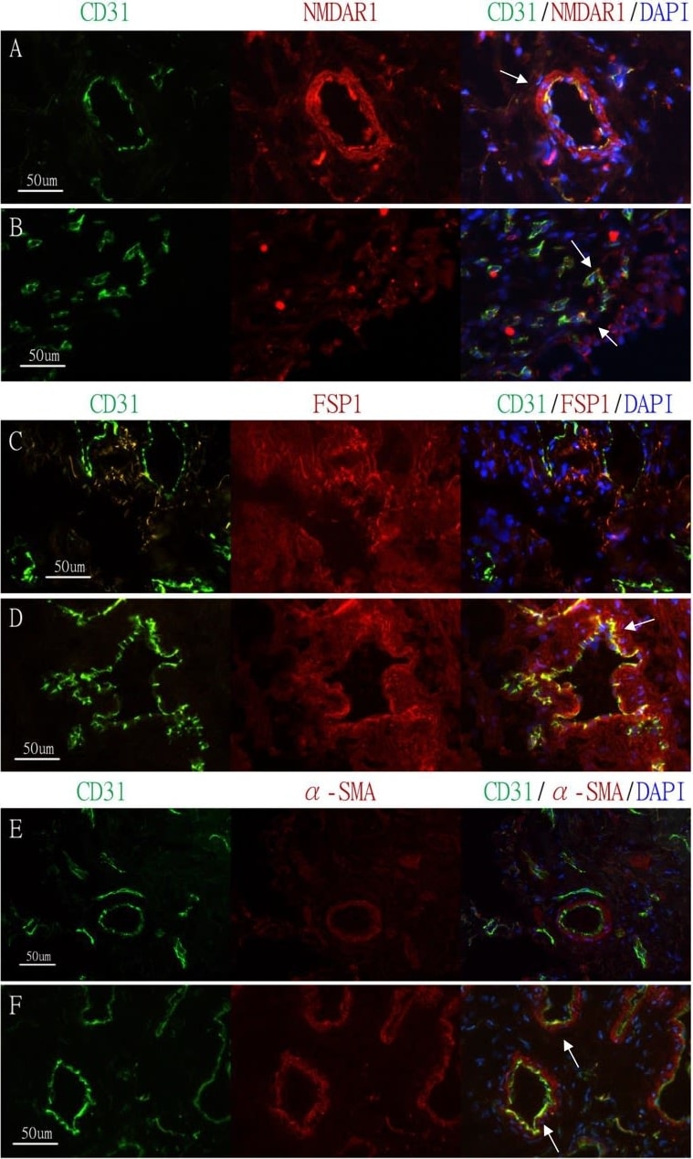 CD31/PECAM-1 Antibody (JC/70A) - BSA Free