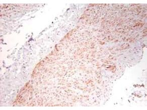 TNF-alpha Antibody - Azide Free
