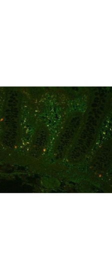 TNF-alpha Antibody - Azide Free