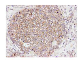 AKT1 [p Ser473] Antibody