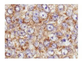 AKT1 [p Ser473] Antibody