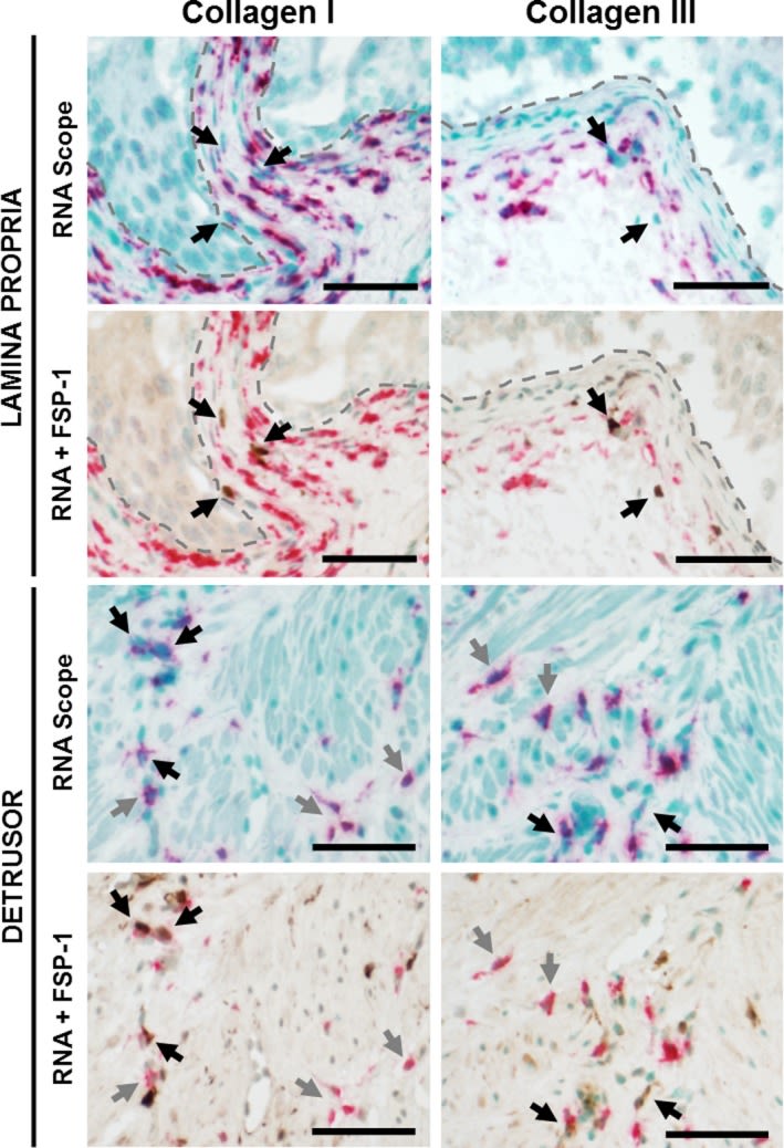 Collagen III alpha 1/COL3A1 Antibody