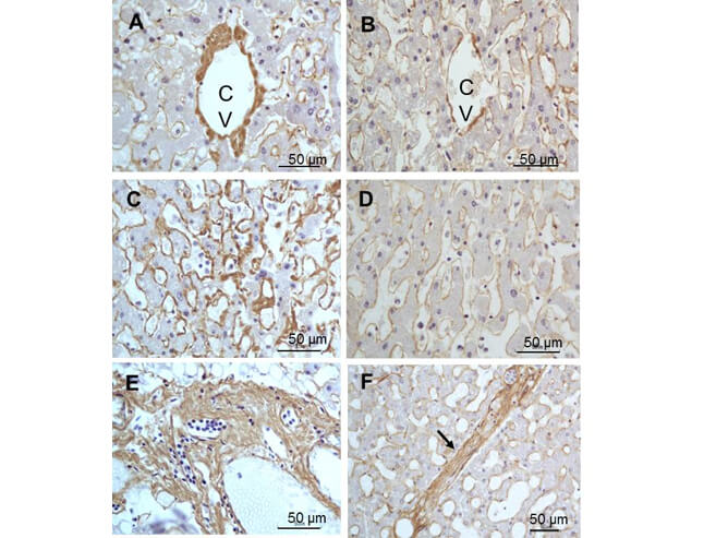 Collagen III alpha 1/COL3A1 Antibody