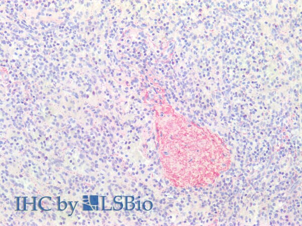Collagen III alpha 1/COL3A1 Antibody