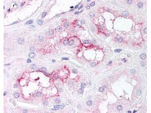 TOR/mTOR [p Ser2448] Antibody