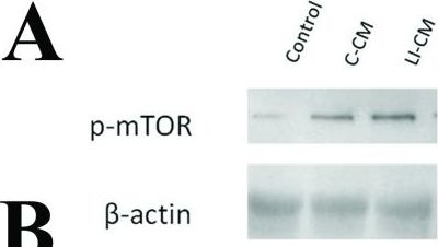 TOR/mTOR [p Ser2448] Antibody