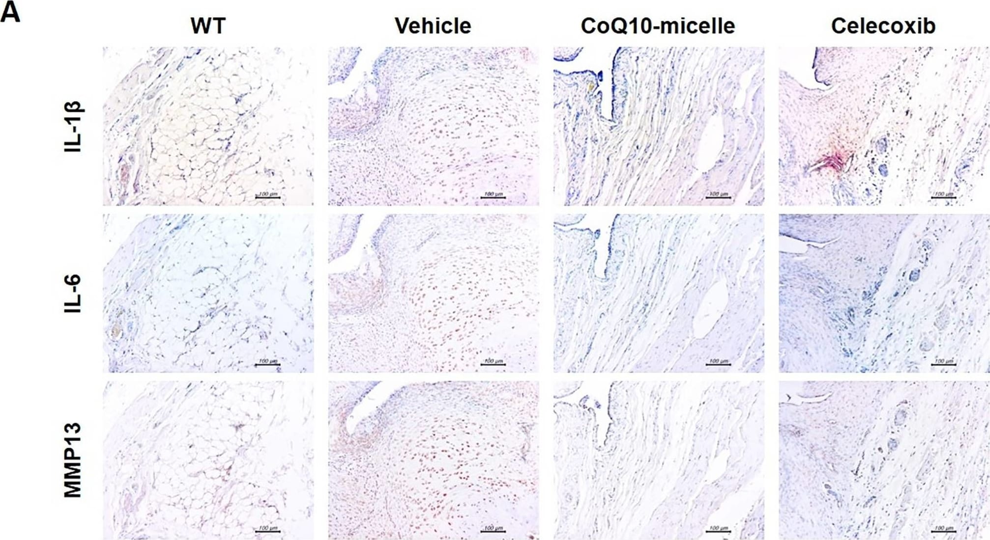 IL-1 beta/IL-1F2 Antibody - Azide and BSA Free