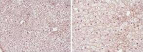 PPAR alpha/NR1C1 Antibody - N-terminal