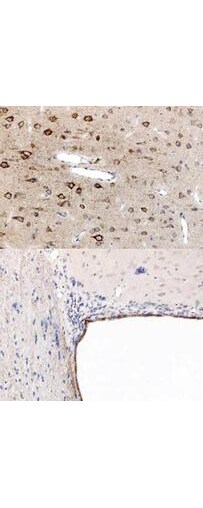 PPAR alpha/NR1C1 Antibody - N-terminal