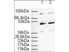 PPAR alpha/NR1C1 Antibody - N-terminal