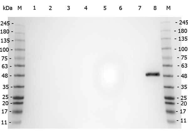 PPAR alpha/NR1C1 Antibody - N-terminal