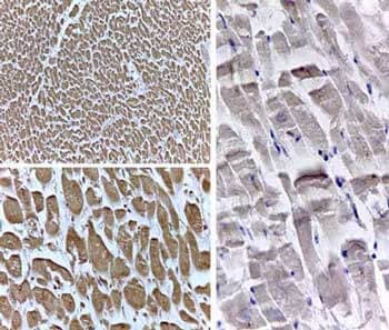 PPAR delta/NR1C2 Antibody - N-terminal