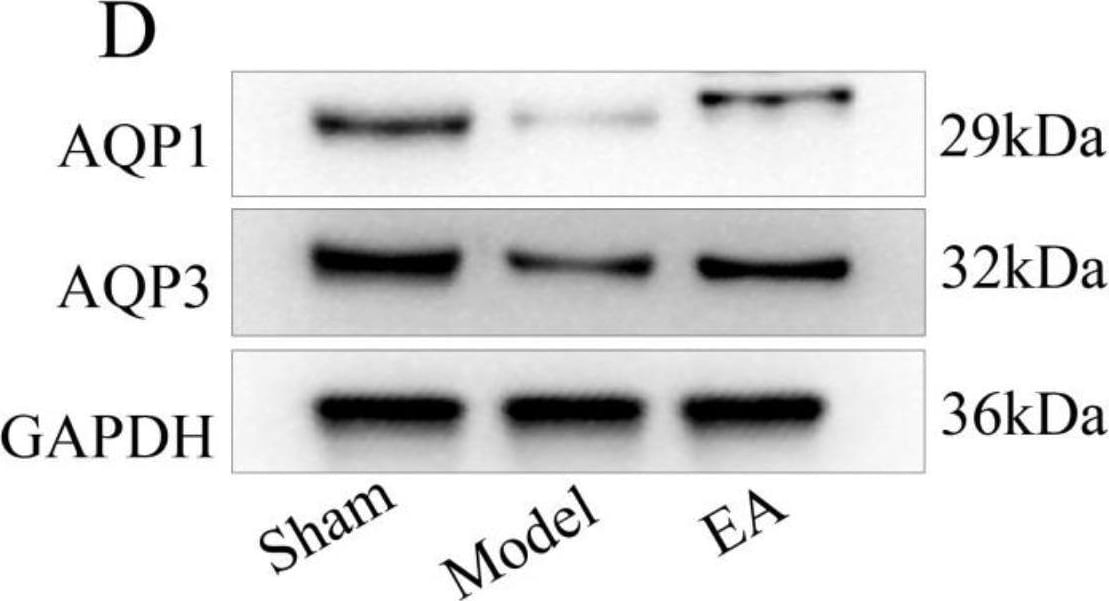 Aquaporin 1/AQP1 Antibody (1/A5F6)