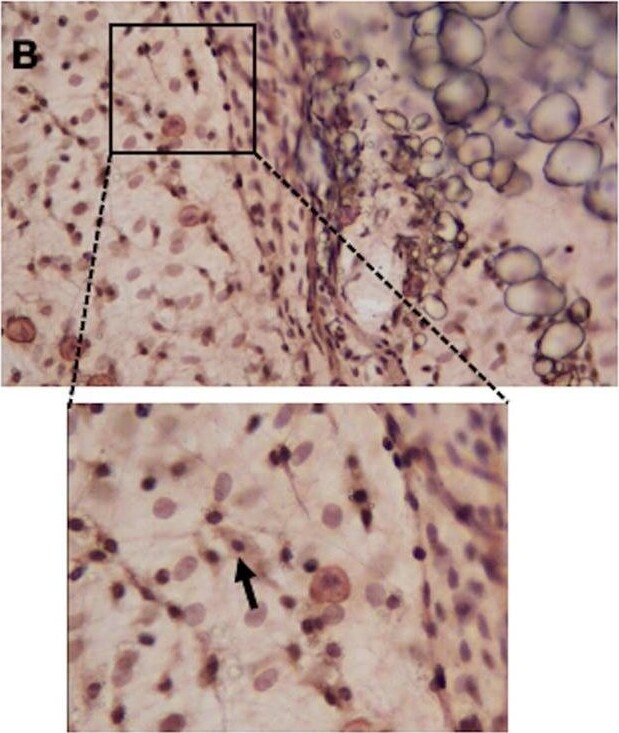 Histamine H2R Antibody