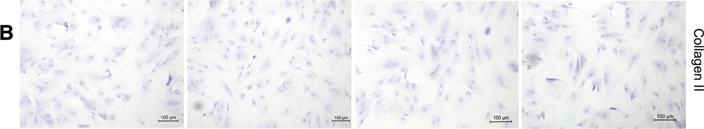 Collagen II Antibody (5B2.5) - BSA Free