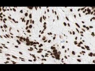GLI-2 Antibody