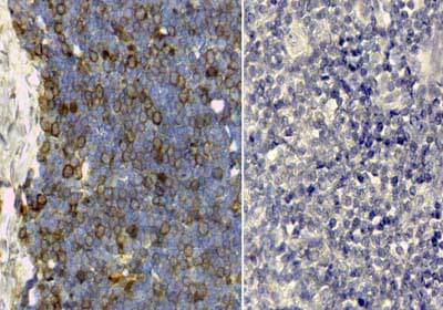 Transferrin Antibody