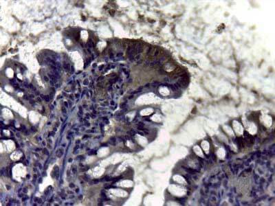 Carbonic Anhydrase II/CA2 Antibody
