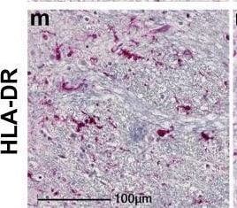 HLA-DR Antibody (TAL 1B5) - BSA Free
