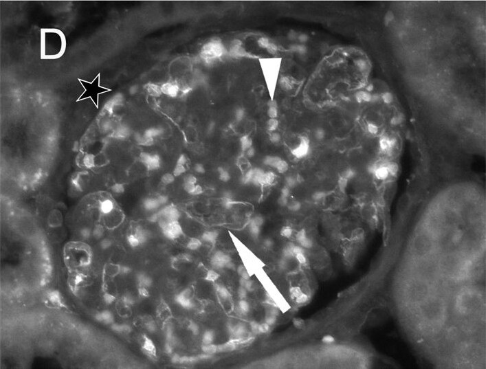 Goat anti-Human IgG Fc Secondary Antibody