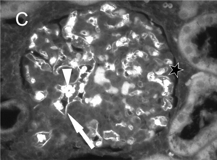 Goat anti-Human IgG Fc Secondary Antibody