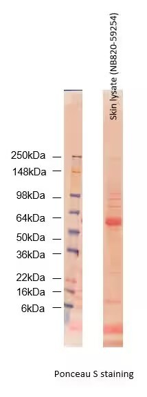 Human Skin Whole Tissue Lysate (Adult Whole Normal)