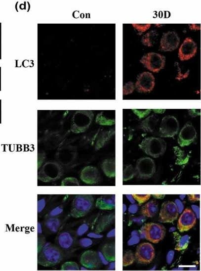 LC3 Antibody Pack