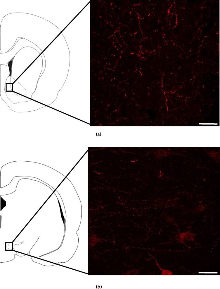Neuromedin UR2/NMUR2 Antibody - BSA Free