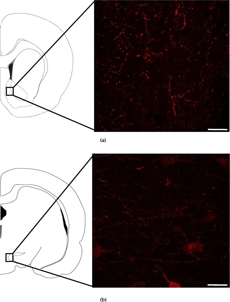 Neuromedin UR2/NMUR2 Antibody - BSA Free