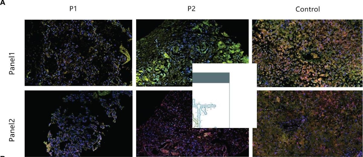 IFN-alpha 1 Antibody