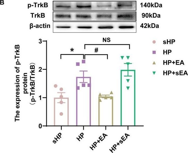 TrkB [p Tyr816] Antibody - Azide and BSA Free