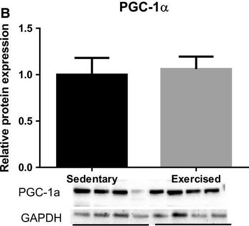 PGC1 alpha Antibody - BSA Free
