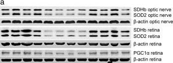 PGC1 alpha Antibody - BSA Free