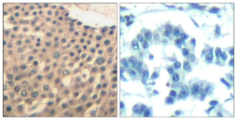 HDAC4+5+9 Antibody - BSA Free