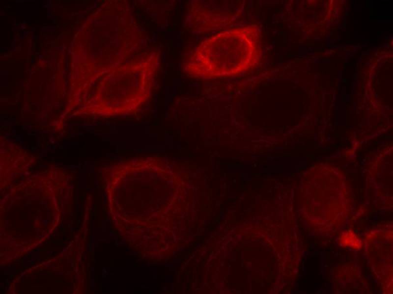 ErbB3/Her3 [p Tyr1328] Antibody - BSA Free