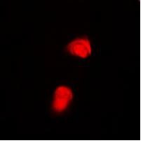 Smad2 [p Thr220] Antibody