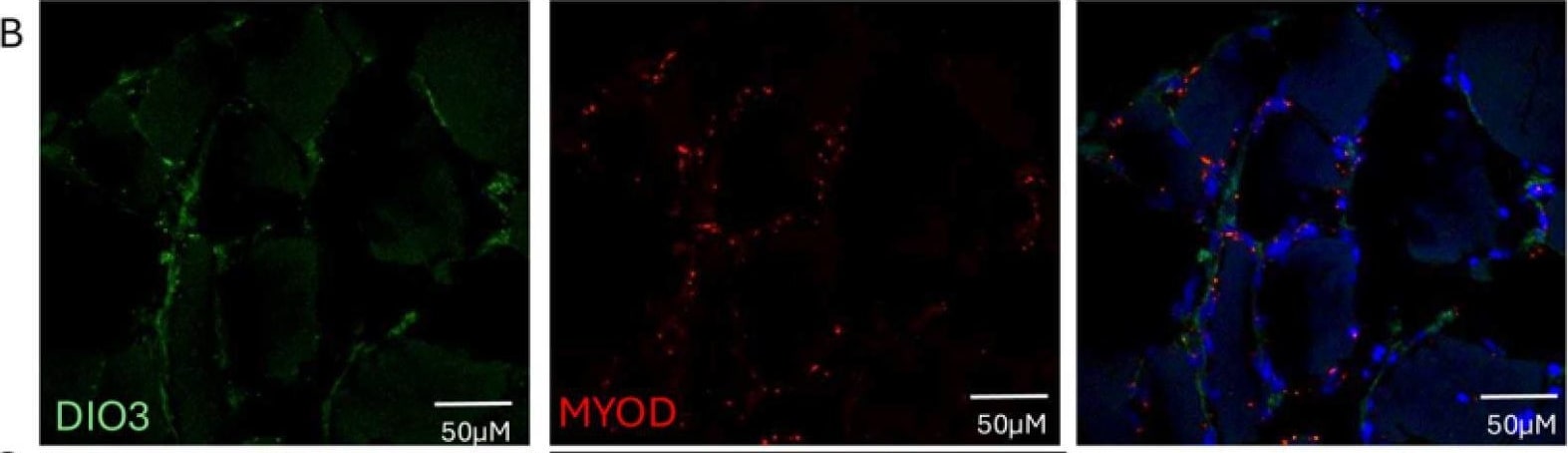 DIO3 Antibody - BSA Free
