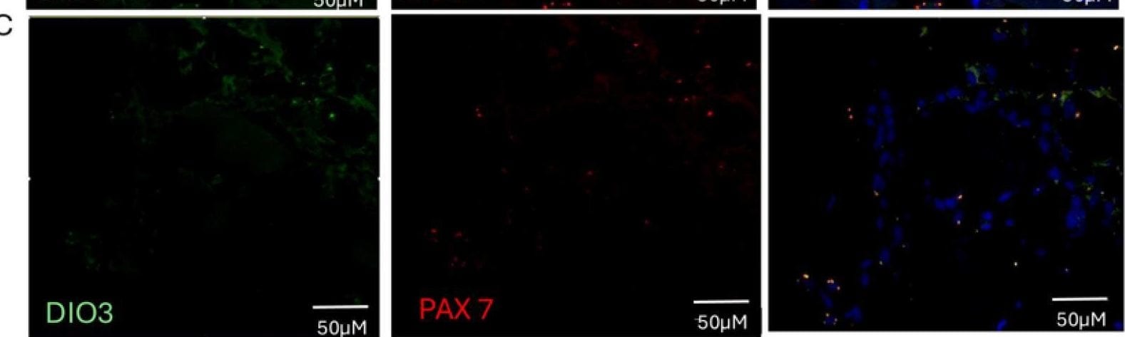 DIO3 Antibody - BSA Free