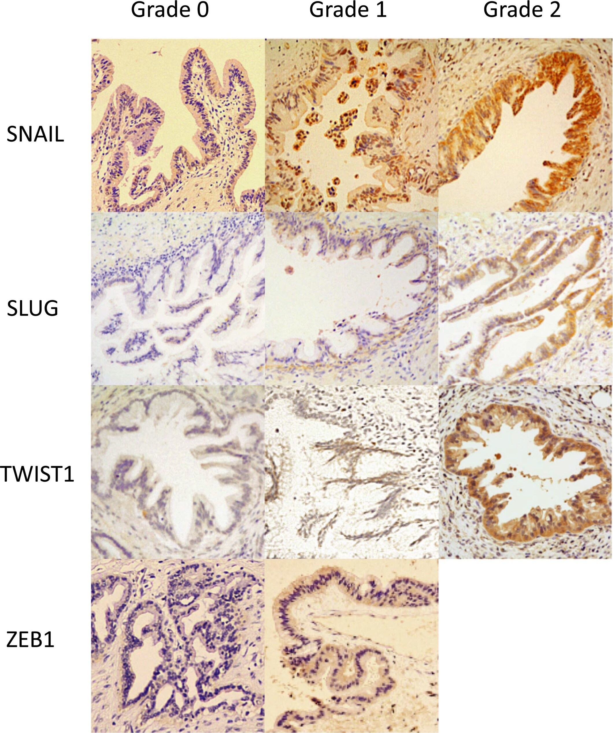 ZEB1 Antibody