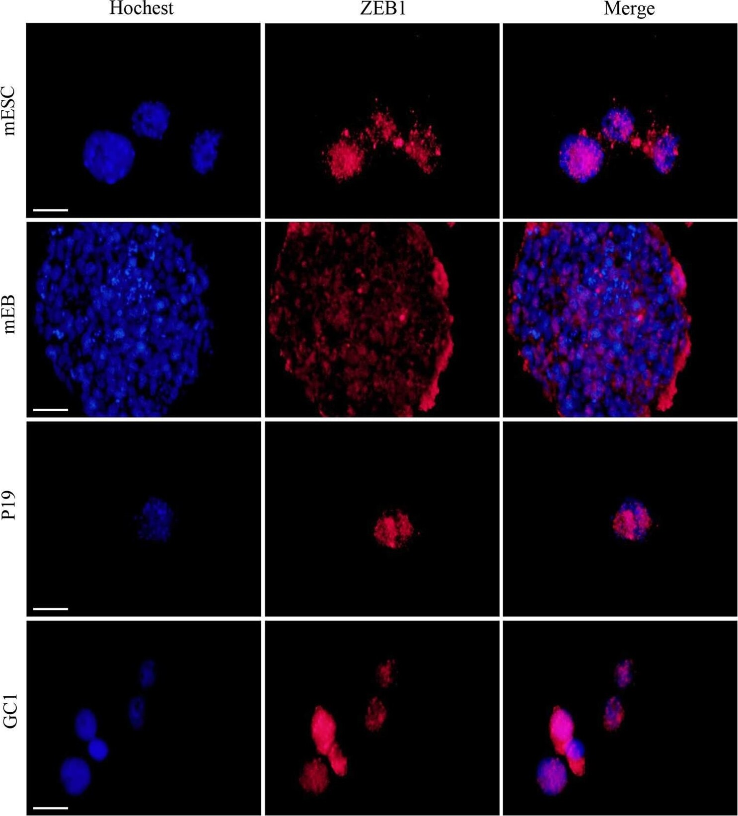 ZEB1 Antibody