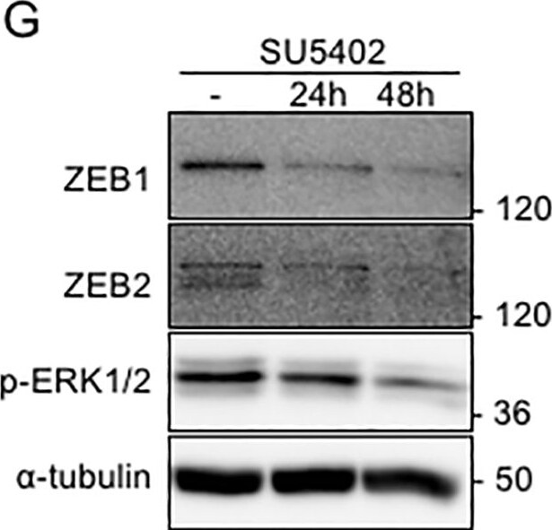 ZEB1 Antibody