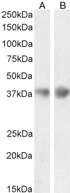 Clusterin/APOJ Antibody