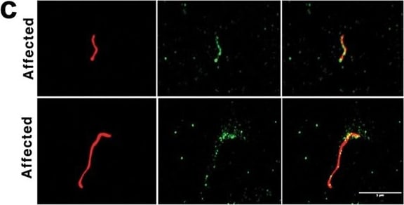 Meckelin Antibody