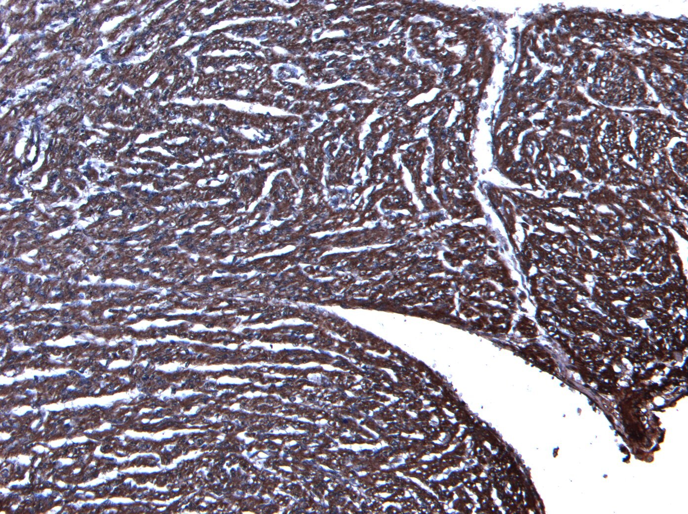 Desmin Antibody