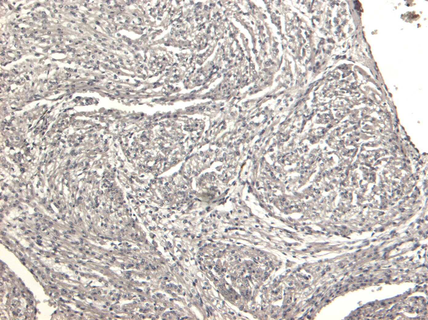Desmin Antibody