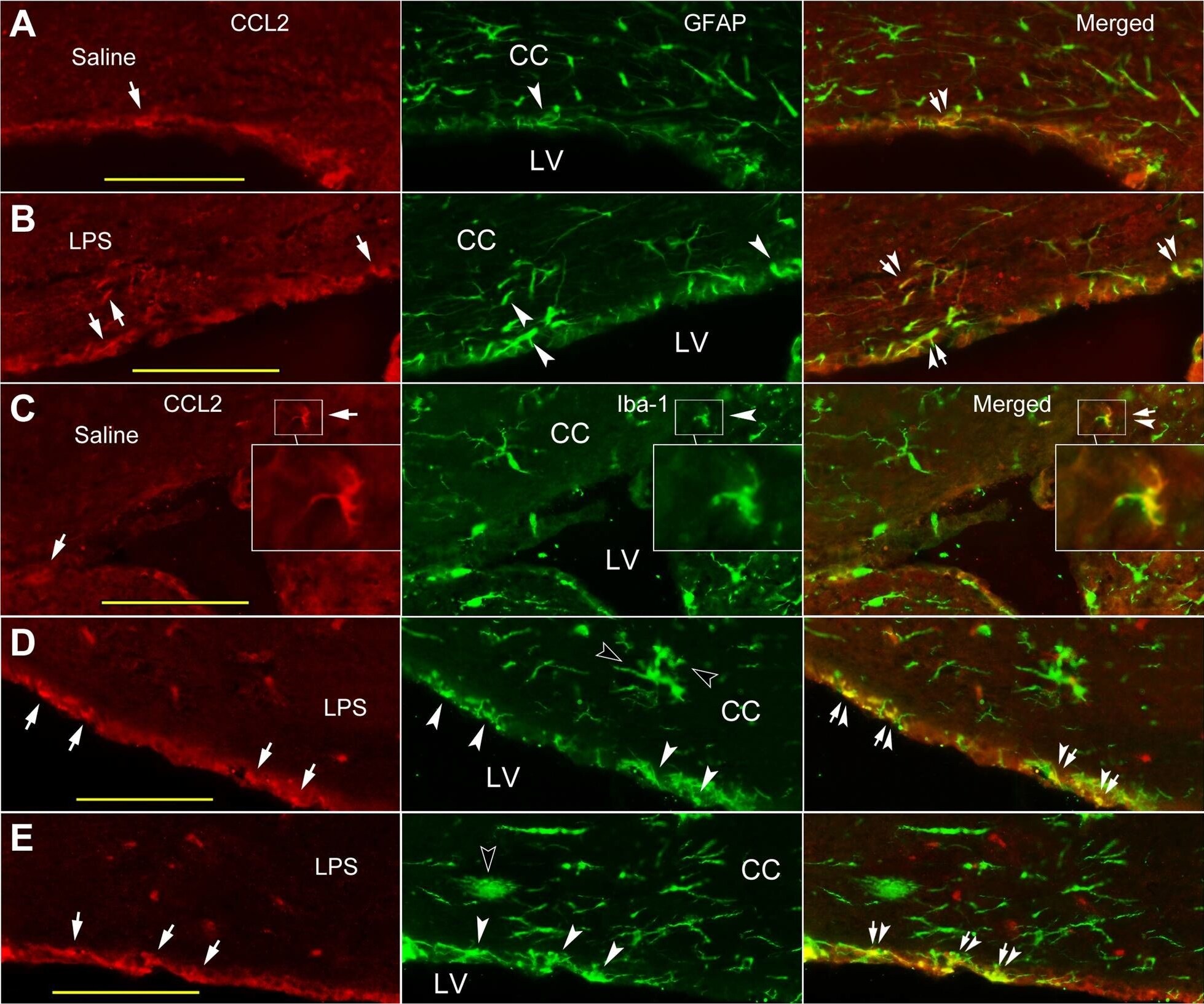 CCL2/MCP1 Antibody - BSA Free