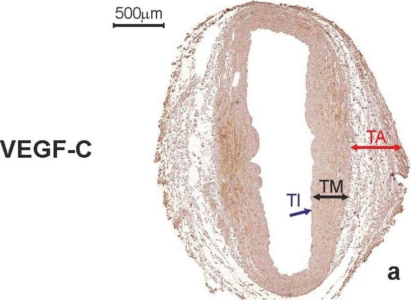 VEGF-C Antibody (107/F10) - Azide and BSA Free