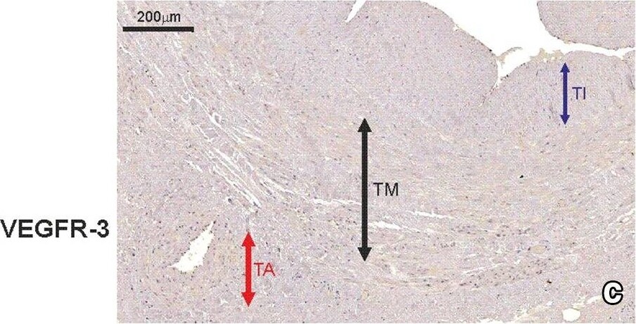 VEGFR3/Flt-4 Antibody (9D9) - Azide and BSA Free